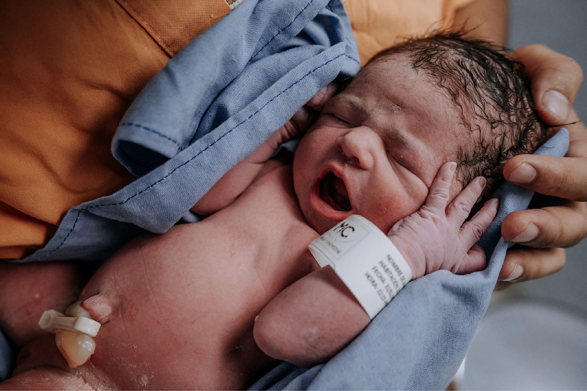 Bebé recién nacido bostezando en brazos, con el brazalete de identificación en la muñeca